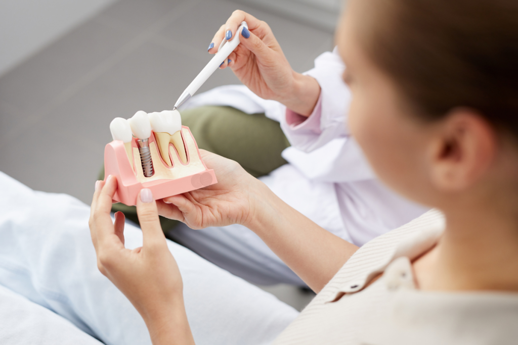 Implant dentar - serviciu stomatologic