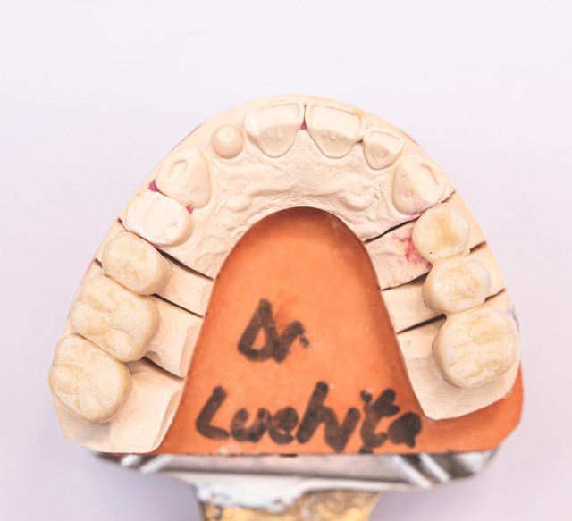dentist Brasov – Luchita Dent