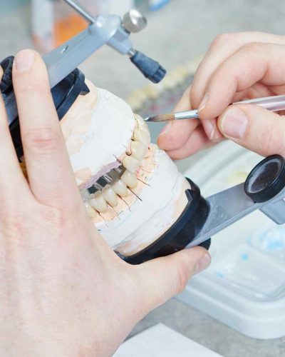 proteza-dentara-servicii-carusel-01