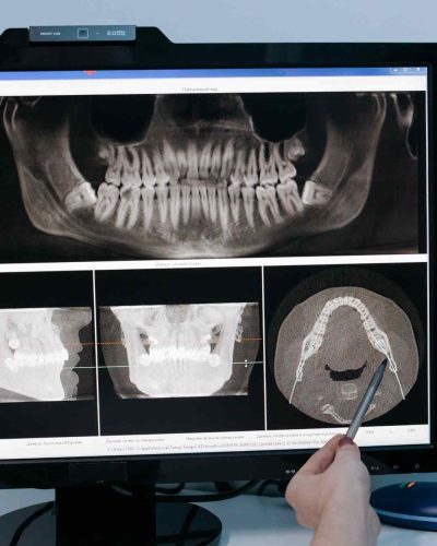 proteza-dentara-servicii-carusel-02