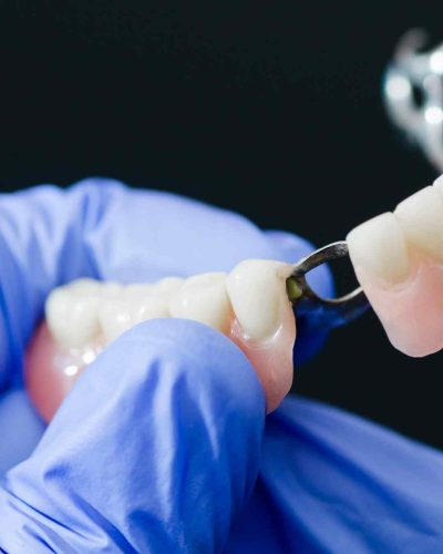 proteza-dentara-servicii-carusel-03