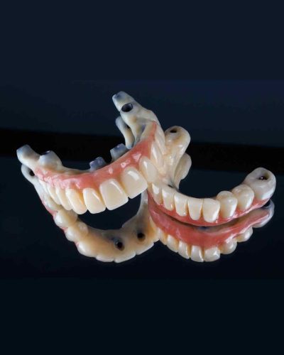 proteza-dentara-servicii-carusel-04