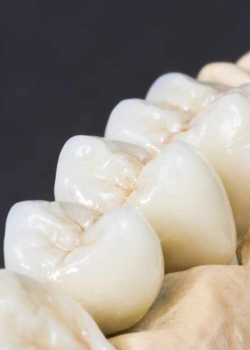 Protetica fixa Brasov